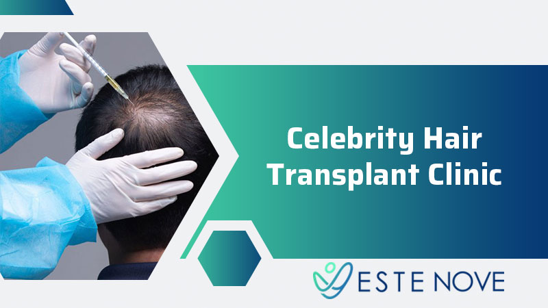 Celebrity Hair Transplant Clinic