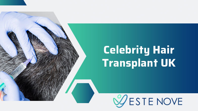 Celebrity Hair Transplant UK