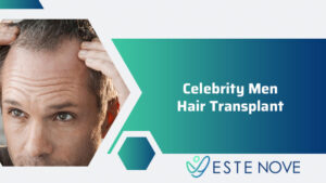 Celebrity Men Hair Transplant