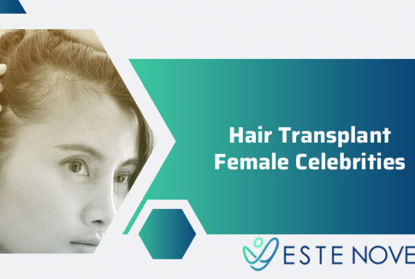 Hair Transplant Female Celebrities