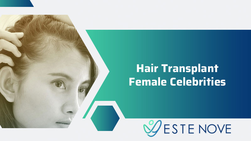 Hair Transplant Female Celebrities