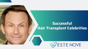 Successful Hair Transplant Celebrities