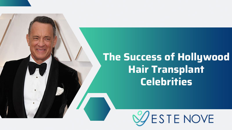 The Success of Hollywood Hair Transplant Celebrities