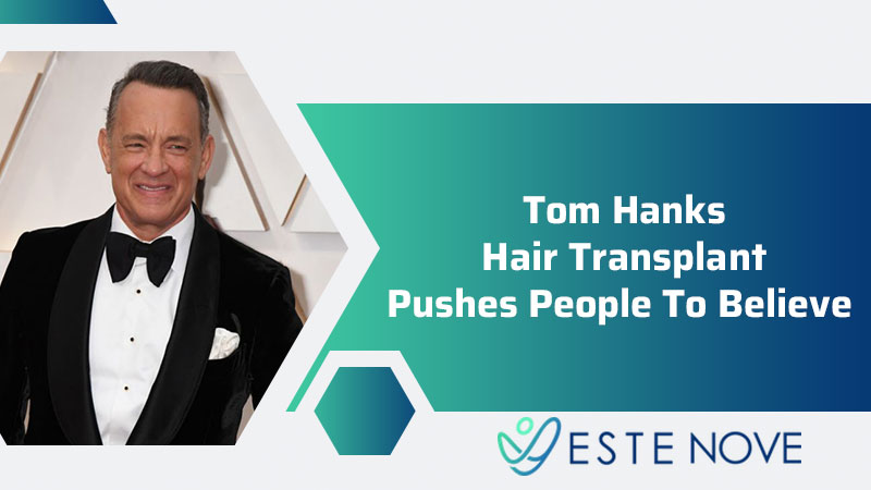 Tom Hanks Hair Transplant Pushes People To Believe