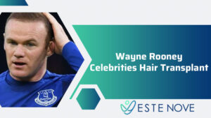Wayne Rooney Celebrities Hair Transplant