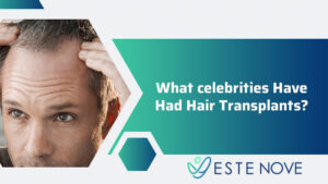 What Celebrities Have Had Hair Transplants 