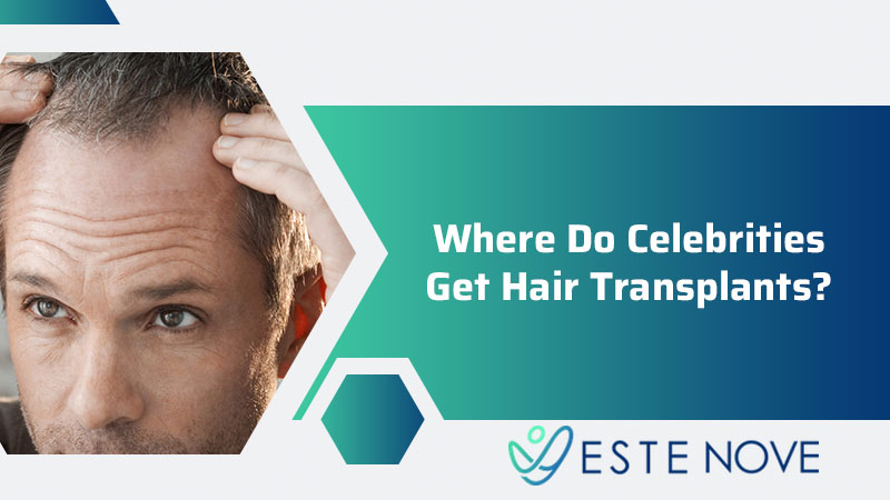 Where Do Celebrities Get Hair Transplants? - Estenove