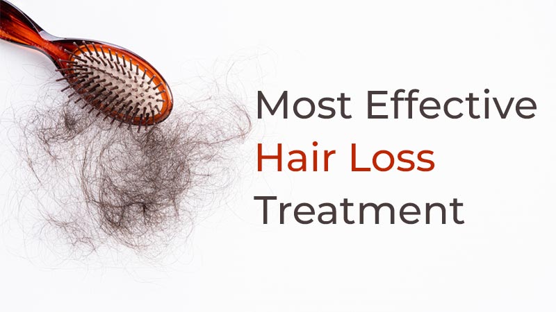 most effective hair loss treatment