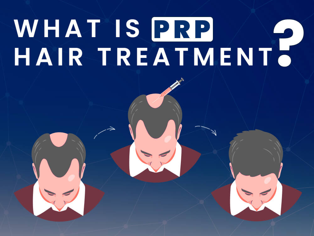 What Is Prp Hair Treatment