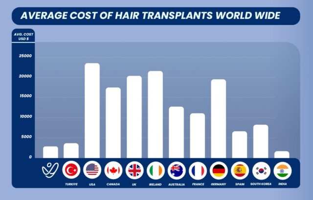 Hair Transplant Average Cost by Country