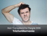 hair transplant for people with trichotillomania