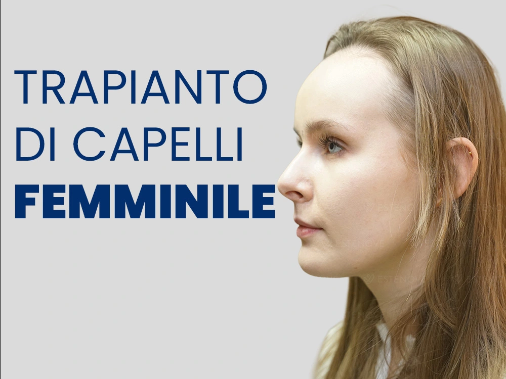 Trapianto di Capelli per Donne in Turchia