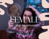 greffe de cheveux féminine