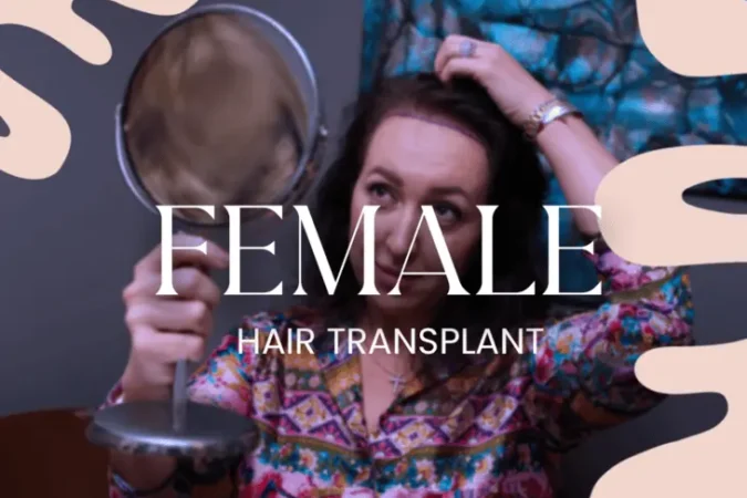 female hair transplant