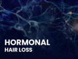 hormonal hair loss tetx with neurons in the background
