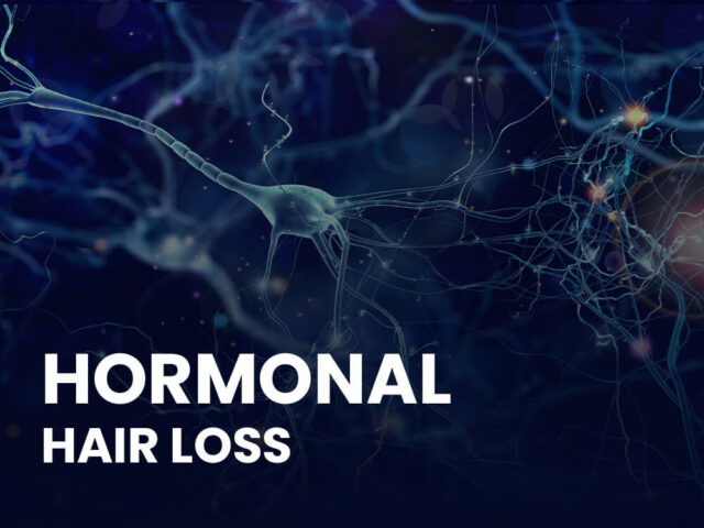 hormonal hair loss tetx with neurons in the background