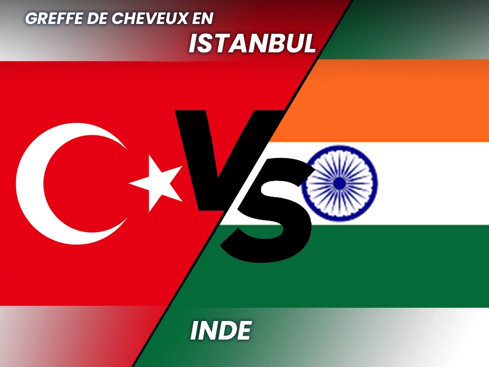 Greffe de cheveux Inde vs Turquie
