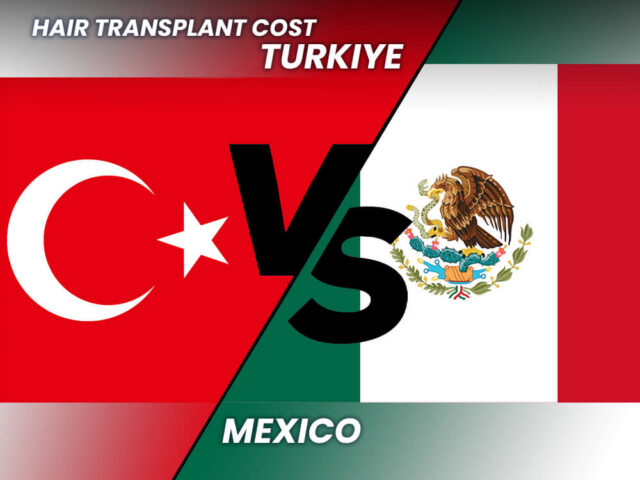 Greffe de cheveux au Mexique vs Turquie