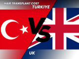 Hair Transplant Cost Comparison between Uk and Turkiye