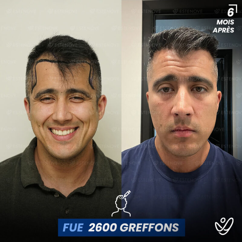 B&A-POST_Template_FRA1 B&A-POST_Template_FRA1