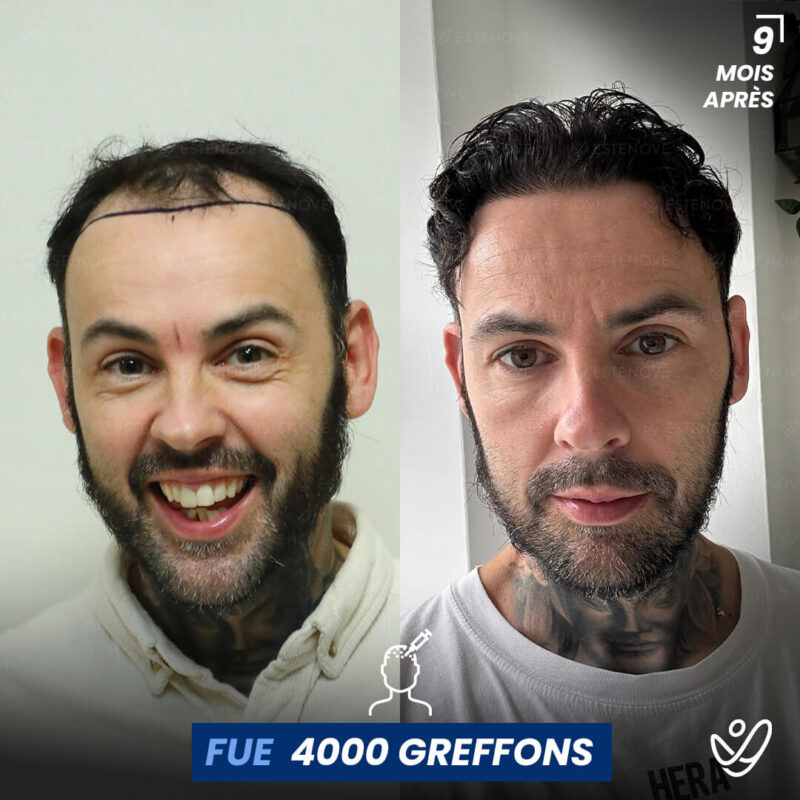 B&A-POST_Template_FRA3 B&A-POST_Template_FRA3