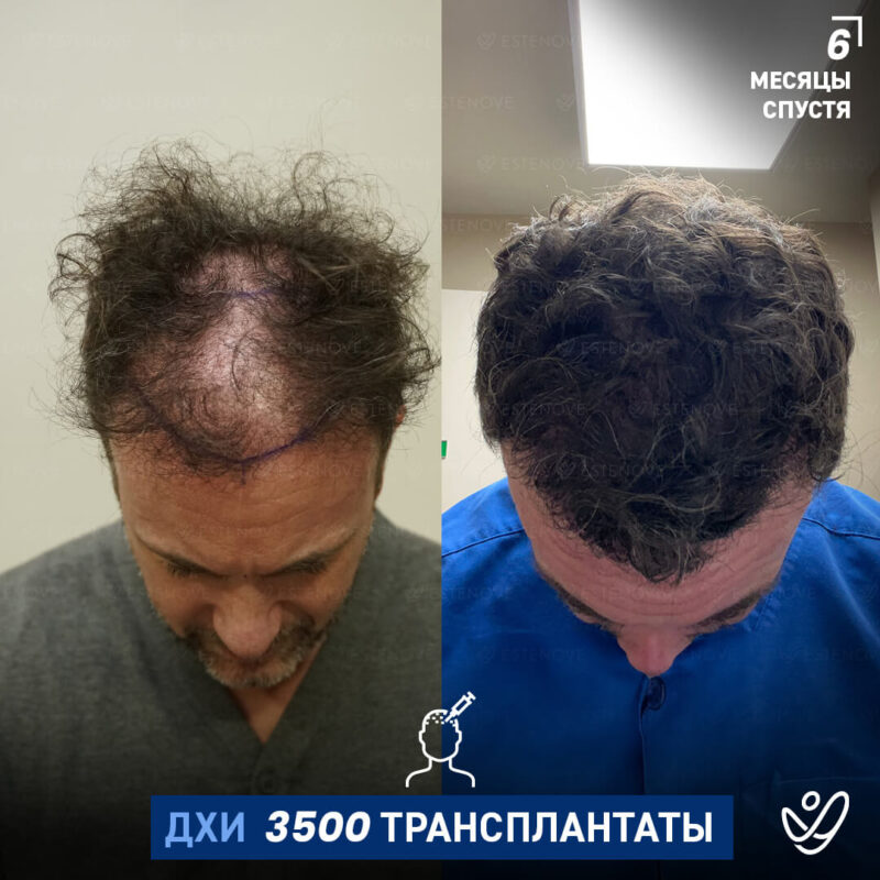 B&A-POST_Template_RUS10 B&A-POST_Template_RUS10