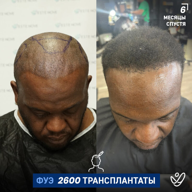 B&A-POST_Template_RUS12 B&A-POST_Template_RUS12