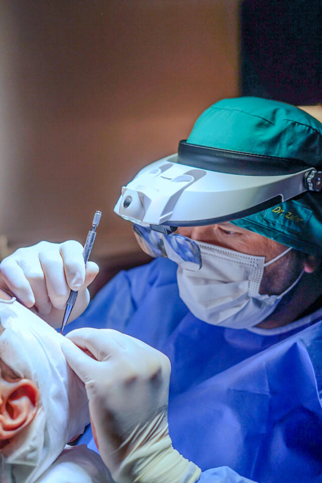 FUE Hair Transplant Surgery in Turkey