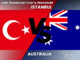 Greffe de cheveux Australie-vs-Turquie --Comparaison des coûts et des procédures