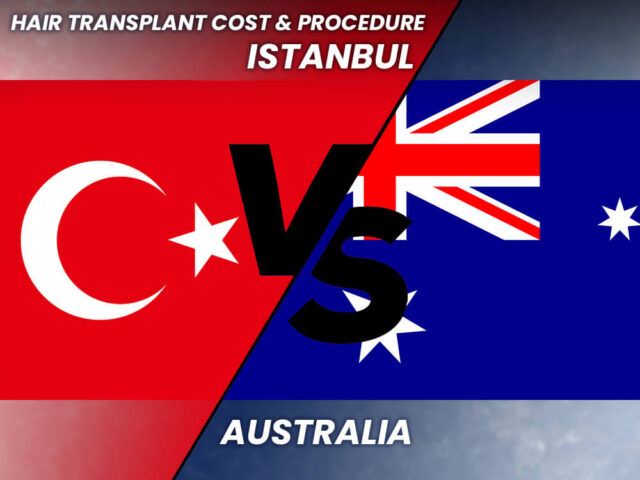 Greffe de cheveux Australie-vs-Turquie --Comparaison des coûts et des procédures