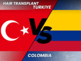 Hair Transplant Colombia vs Turkey Cost & Procedure Comparison