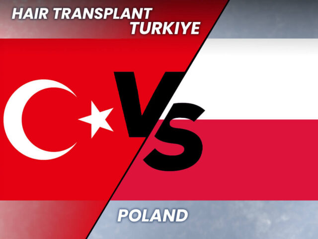 Greffe de cheveux Pologne vs Turquie