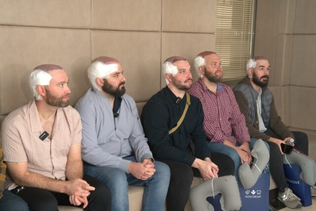 members of barstool after their hair tranplant operations