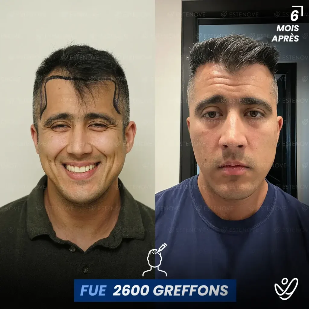 B&A-POST_Template_FRA1