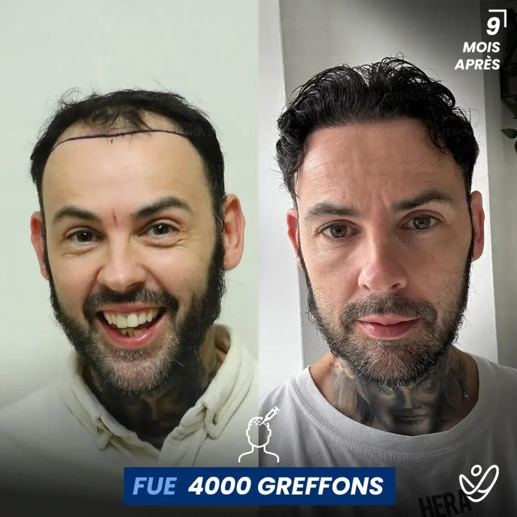 B&A-POST_Template_FRA3