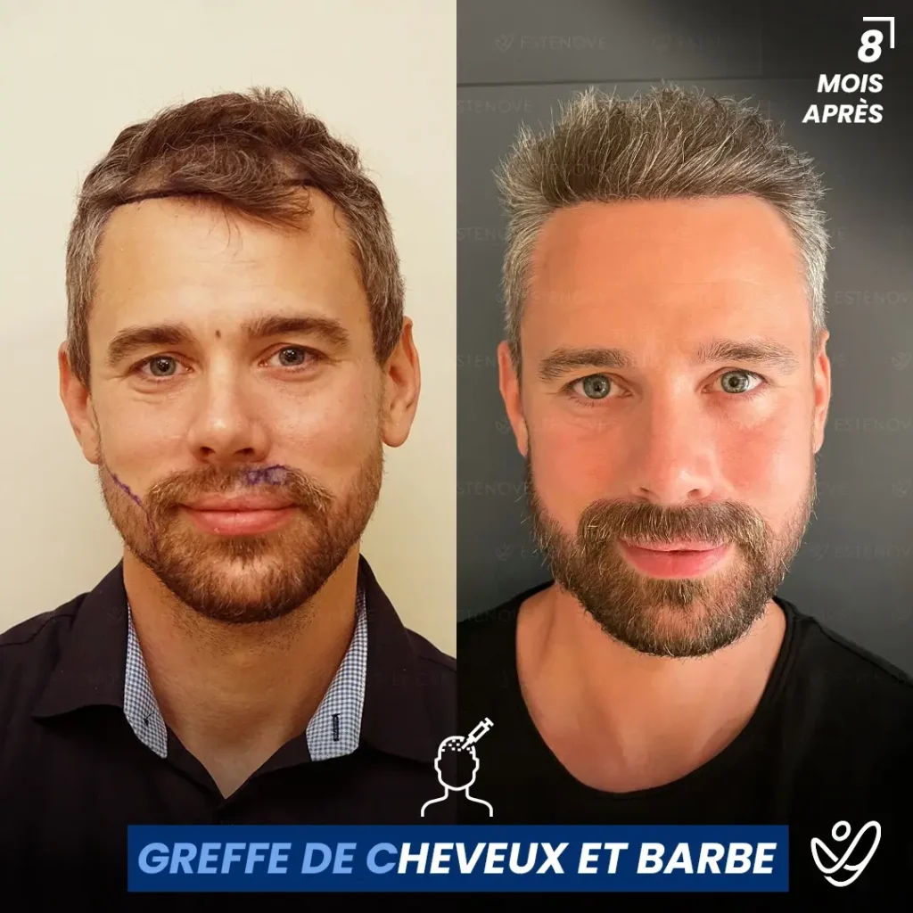 B&A-POST_Template_FRA4