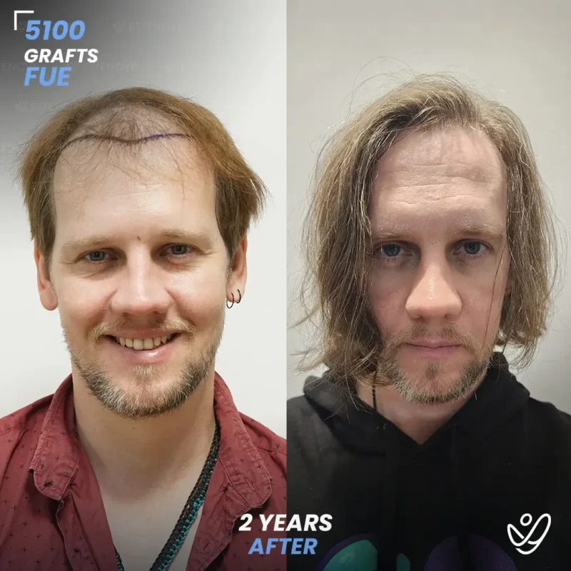 Benjamin-Newall1 (1) Benjamin-Newall1 (1)