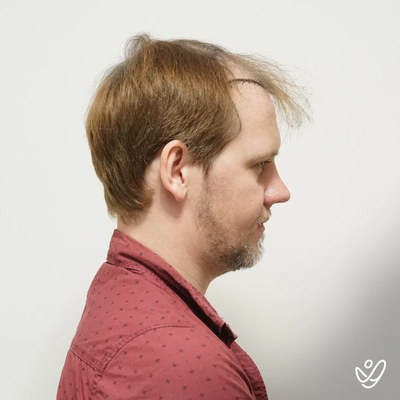 Benjamin-Newall10 Benjamin-Newall10