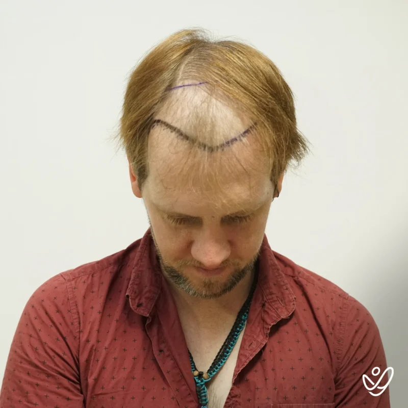 Benjamin-Newall14 Benjamin-Newall14