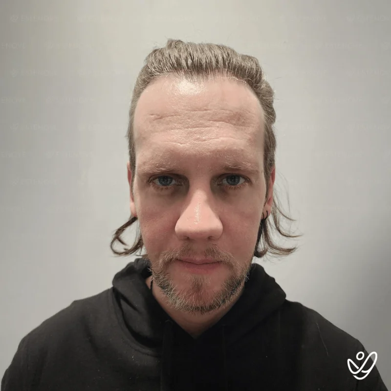 Benjamin-Newall15 Benjamin-Newall15