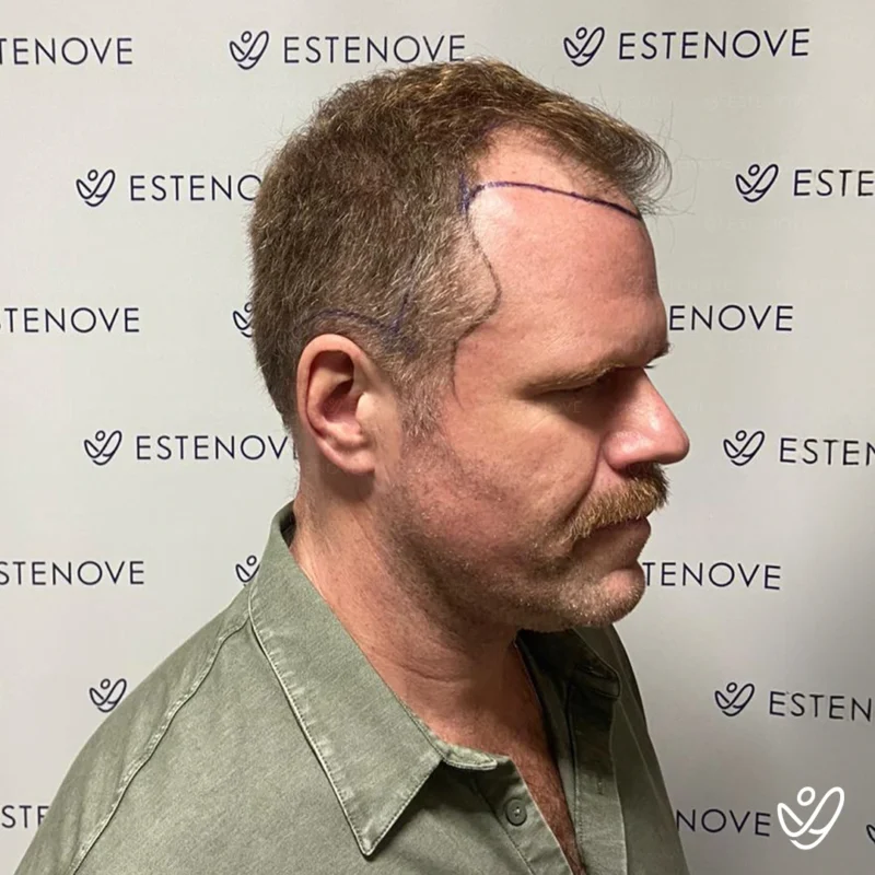 Matthew-Scholl10 Matthew-Scholl10