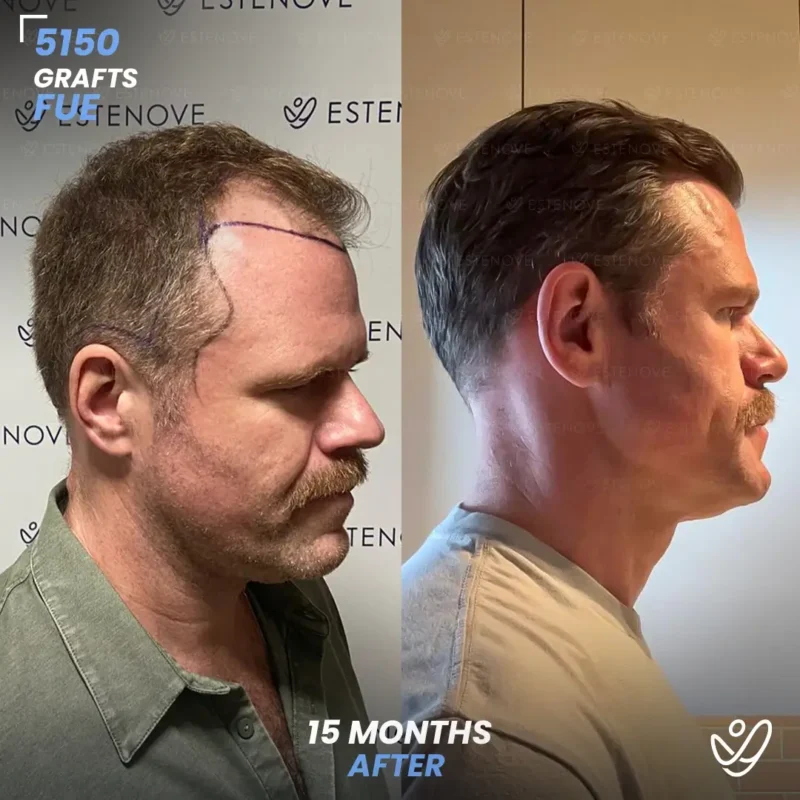 Matthew-Scholl3 Matthew-Scholl3