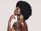 Hair Transplant for Black Females in Turkey