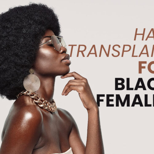 Hair Transplant for Black Females in Turkey