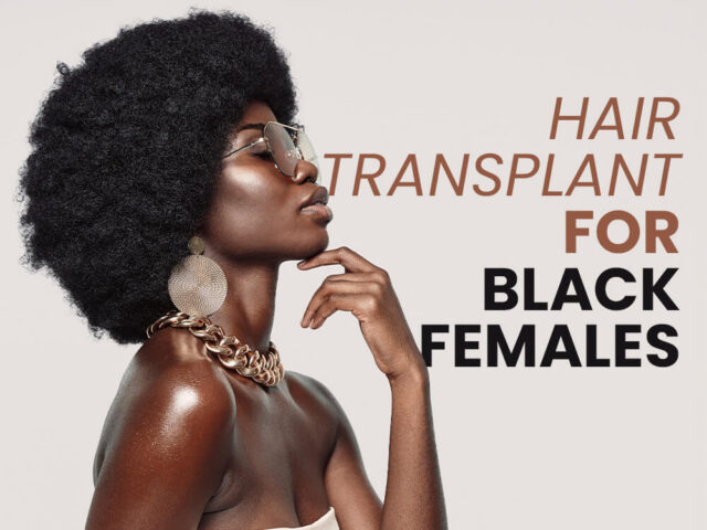 Trasplante capilar para mujeres negras en Turquía