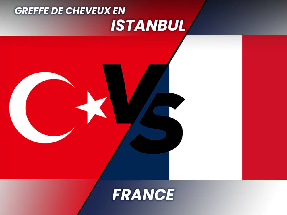 Hair Transplant in France vs Turkey