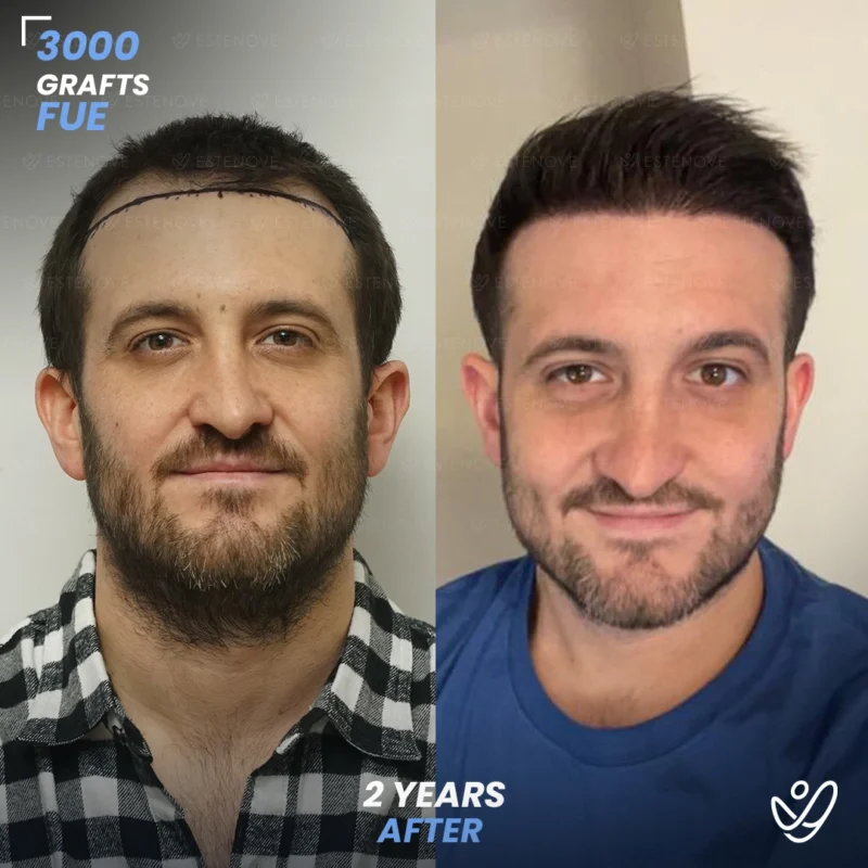 Joey_Intrabartolo-1 Joey_Intrabartolo-1