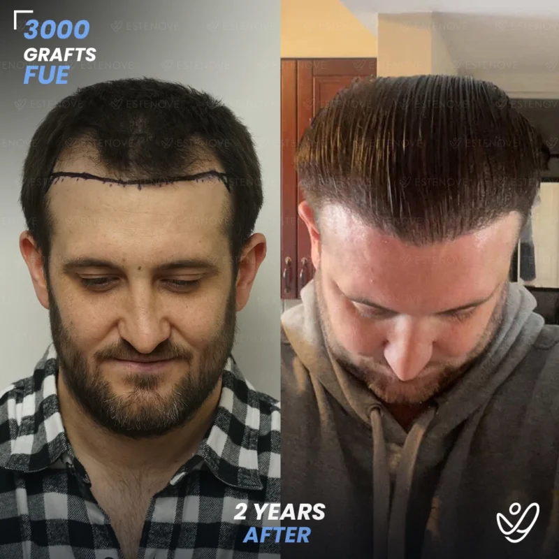 Joey_Intrabartolo-2 Joey_Intrabartolo-2