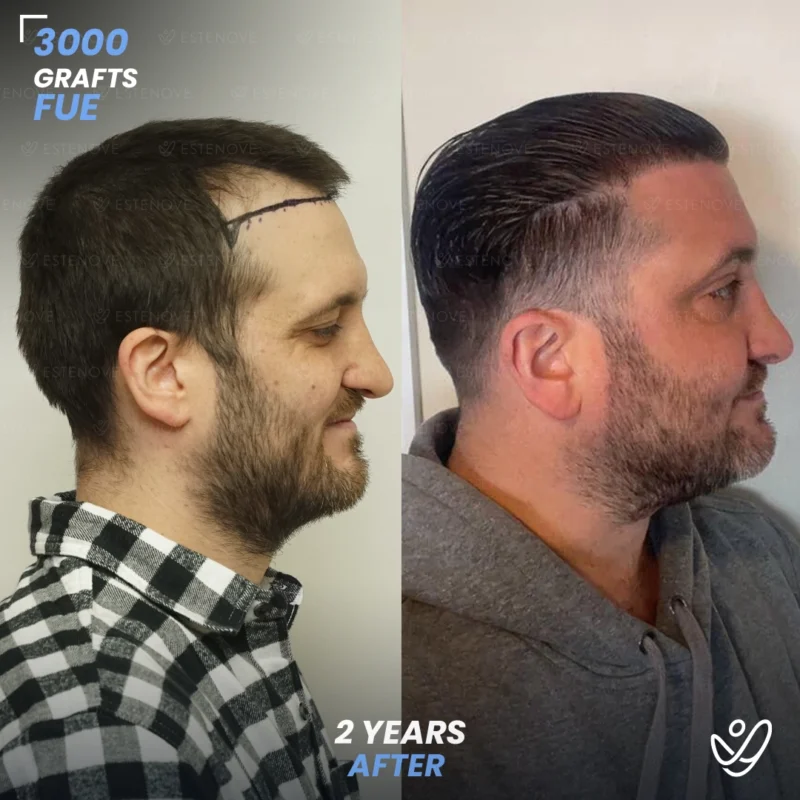 Joey_Intrabartolo-3 Joey_Intrabartolo-3