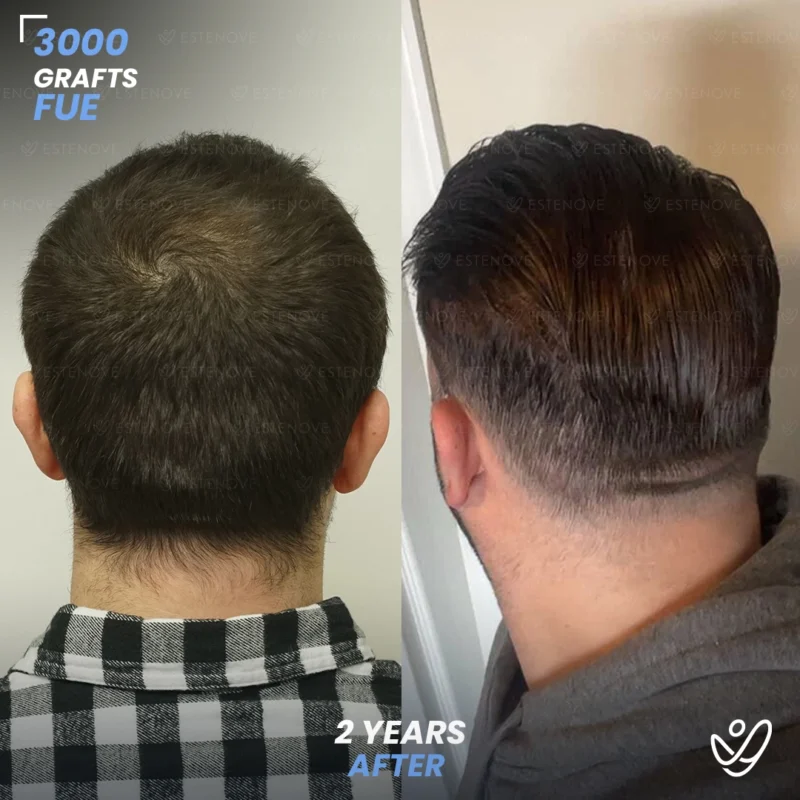 Joey_Intrabartolo-5 Joey_Intrabartolo-5